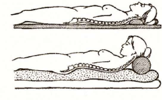 Slika osteohondroze